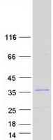 Human TIP30 / HTATIP2 Protein (Recombinant Myc-DDK (Flag))