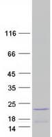 Human HIST1H2BF Protein (Recombinant Myc-DDK (Flag))