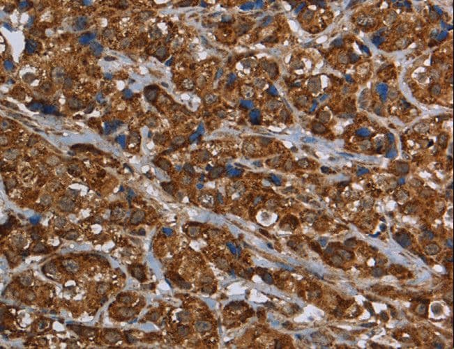 Polyclonal Rabbit anti-Human GCKR Antibody (IHC)