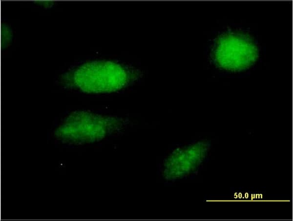 FOXC2 Antibody (clone 2H3)