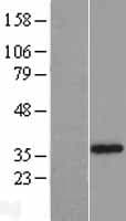 SLC25A16 / GDA / Graves Protein (Over-Expression Lysate Myc-DDK (Flag))