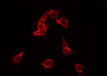 Polyclonal Rabbit anti-Human FLT1 / VEGFR1 Antibody (phospho-Tyr1213, IF, WB)