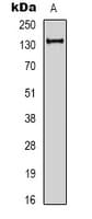 CDH1 / E Cadherin Antibody