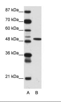ETV5 / ERM Antibody (aa61-110)