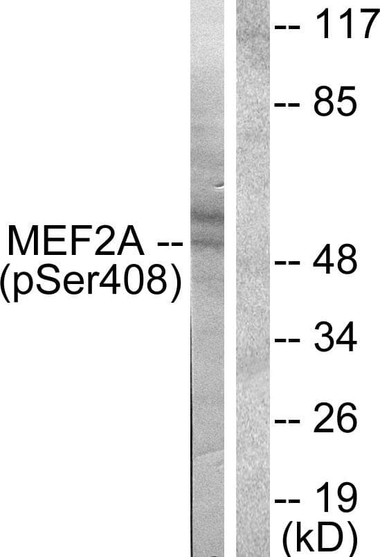 MEF2A / MEF2 Antibody (phospho-Ser408)