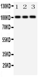 NEP / DDR1 Antibody (aa898-913)