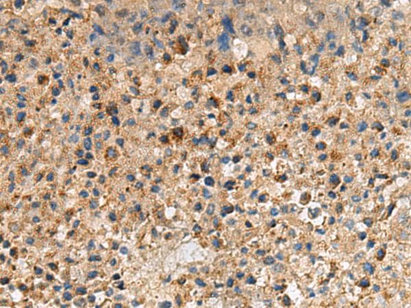 Polyclonal Rabbit anti-Human CXCR5 Antibody (IHC)