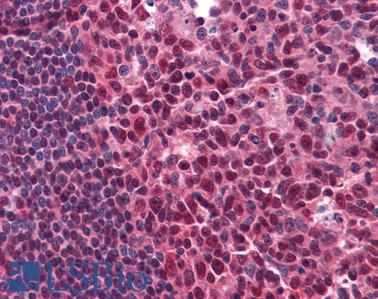 IHC-plus™ RCHY1 / PIRH2 Antibody (clone 1H10)
