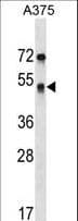 SEPT11 / Septin 11 Antibody (aa353-382)