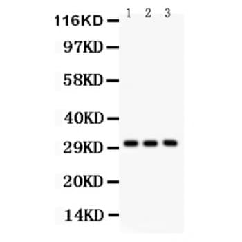 VDAC1 / PORIN Antibody (aa154-181)