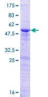Human ZCCHC9 Protein (Recombinant GST)