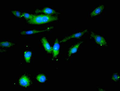 BCHE / Cholinesterase Antibody