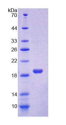 Rat CCL2 / MCP1 Protein (Recombinant His)