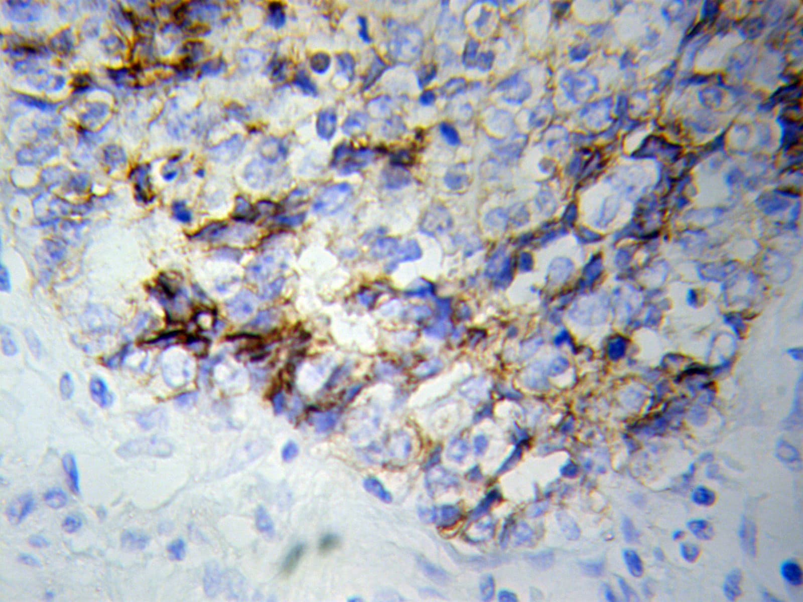 NF-L / NEFL Antibody