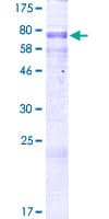 Human CSNK1G3 / CKI-Gamma 3 Protein (Recombinant GST)
