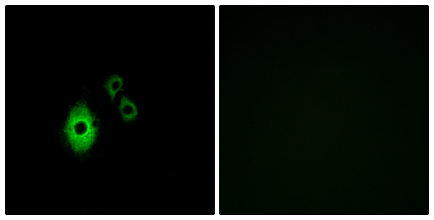 KCNJ5 / Kir3.4 / GIRK4 Antibody (aa370-419)
