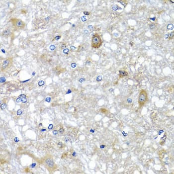 ETFA Antibody