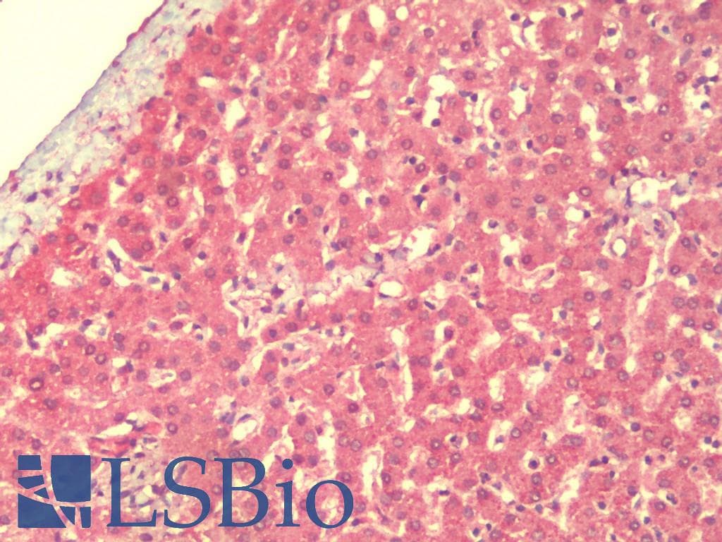 IHC-plus™ Polyclonal Rabbit anti-Human LMNTD1 / IFLTD1 Antibody (IHC, WB)