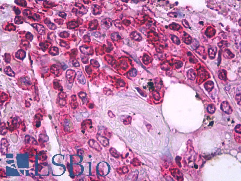 CD45RO Antibody (clone UCHL1, FITC)