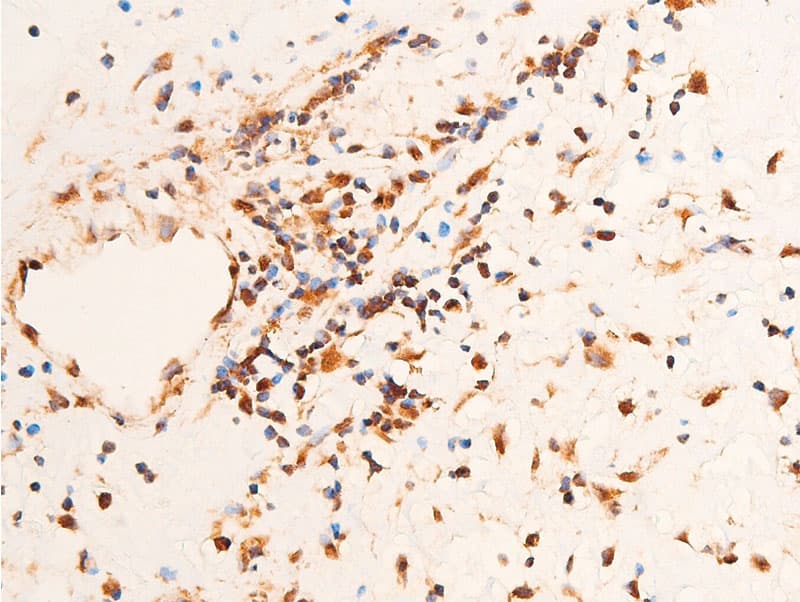 Polyclonal Rabbit anti-Human CHEK1 / CHK1 Antibody (phospho-Ser296, IHC, IF, WB)