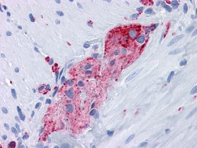 SYP / Synaptophysin Antibody (clone 7H12)