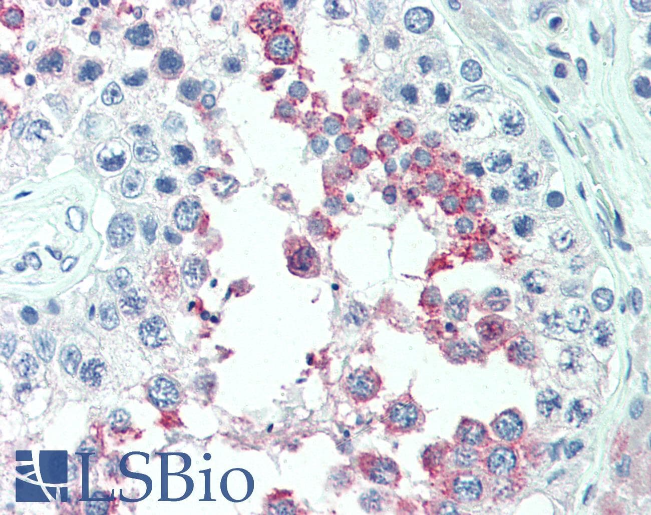IHC-plus™ Polyclonal Rabbit anti-Human ERMP1 Antibody (Internal, IHC)