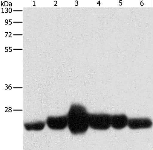CAV1 / Caveolin 1 Antibody