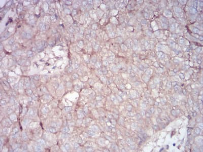 Monoclonal Mouse anti-Human RALA / RAL Antibody (clone 4G8C7, IHC, WB)