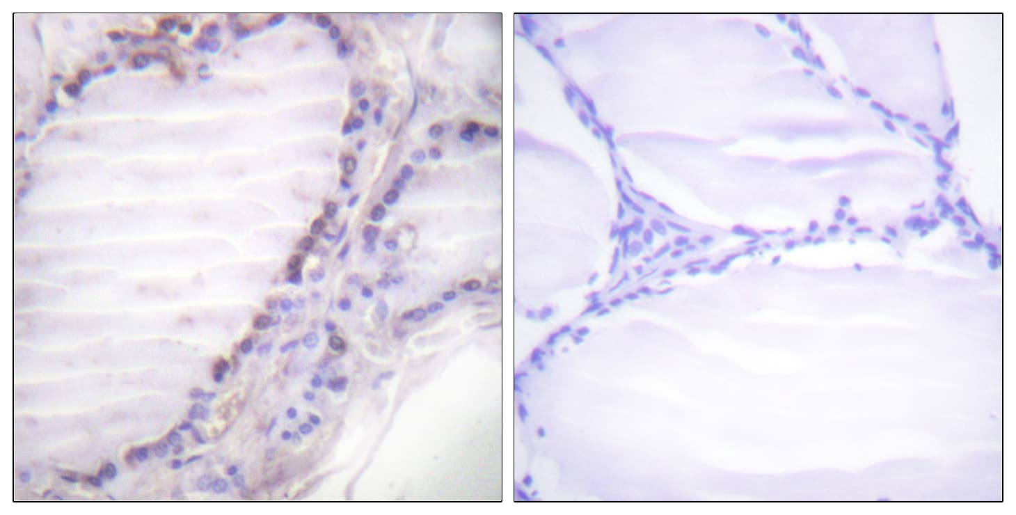 FOS / c-FOS Antibody (phospho-Ser362)