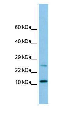 DYNLRB1 Antibody (aa23-72)