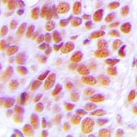 Polyclonal Rabbit anti-Human NOL10 Antibody (IHC, WB)