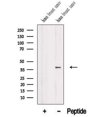 ARPC1B / p41-ARC / ARP2 Antibody