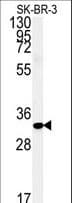 FAM92A1 Antibody (aa113-141)