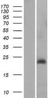 MRPL30 Protein (Over-Expression Lysate Myc-DDK (Flag))