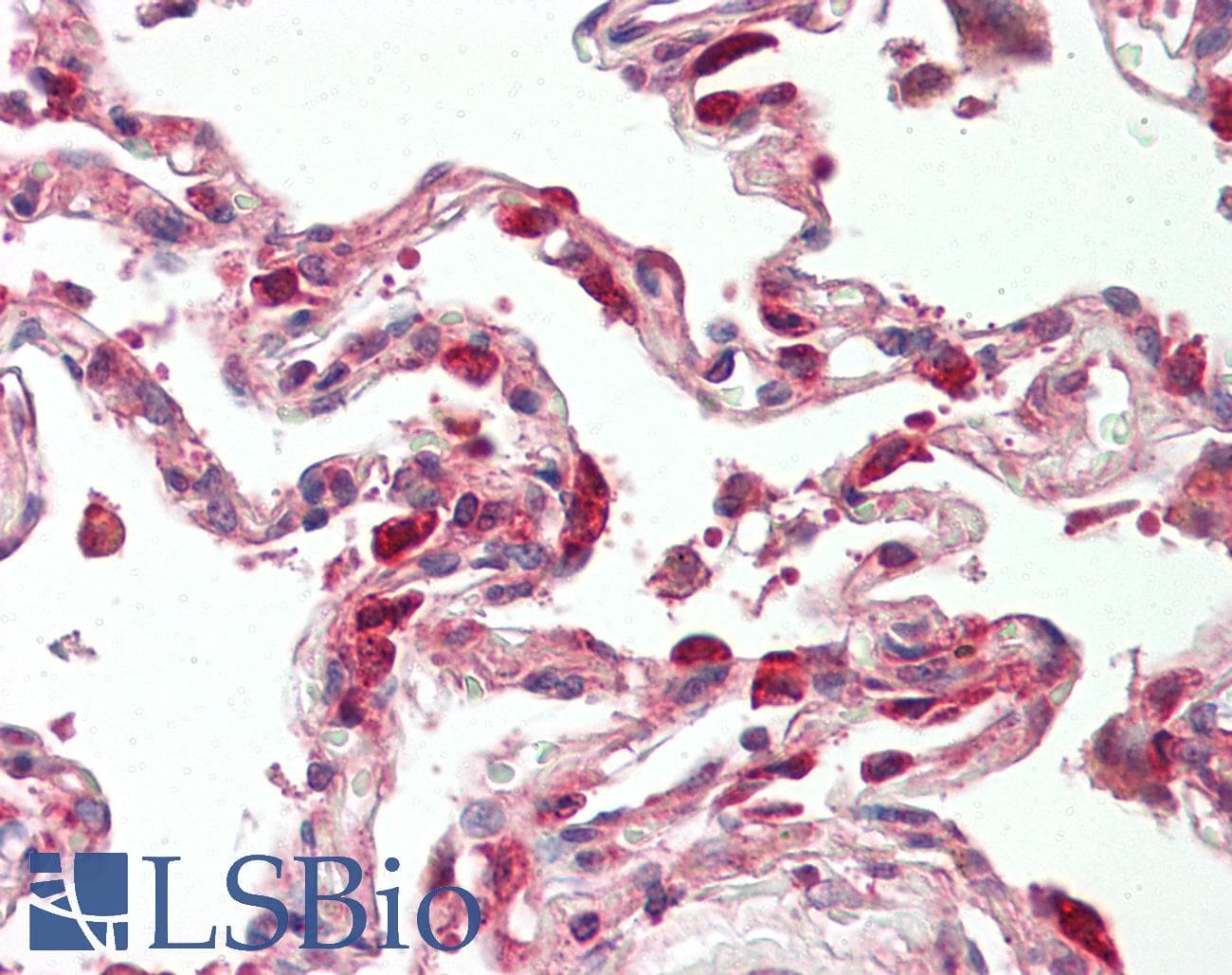 IHC-plus™ Polyclonal Rabbit anti-Human TSC22D1 / TSC22 Antibody (aa1000-1030, IHC, IF, WB)