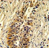 TALDO1 / Transaldolase 1 Antibody (aa186-215)