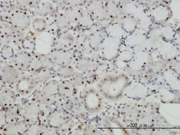 Monoclonal Mouse anti-Human TRAF4 Antibody (clone 3F6, IHC, WB)