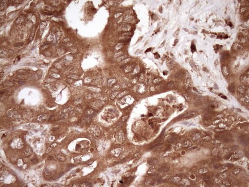 Monoclonal Mouse anti-Human FSCN1 / Fascin Antibody (clone OTI3B4, IHC, WB)