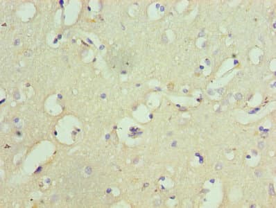 Polyclonal Rabbit anti-Human GRIA1 / GLUR1 Antibody (aa19-300, IHC)