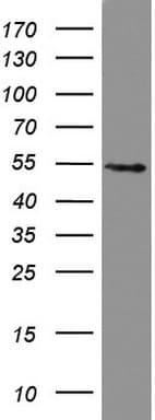 HMBS / PBGD Antibody (clone UMAB144)
