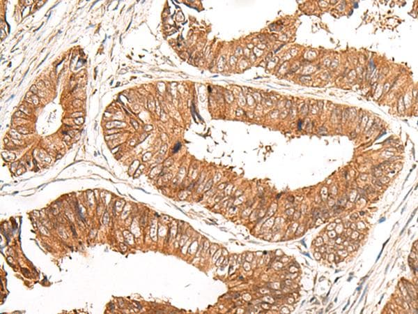 GFI1 Antibody