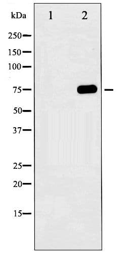 MAPT / Tau Antibody (phospho-Ser404)