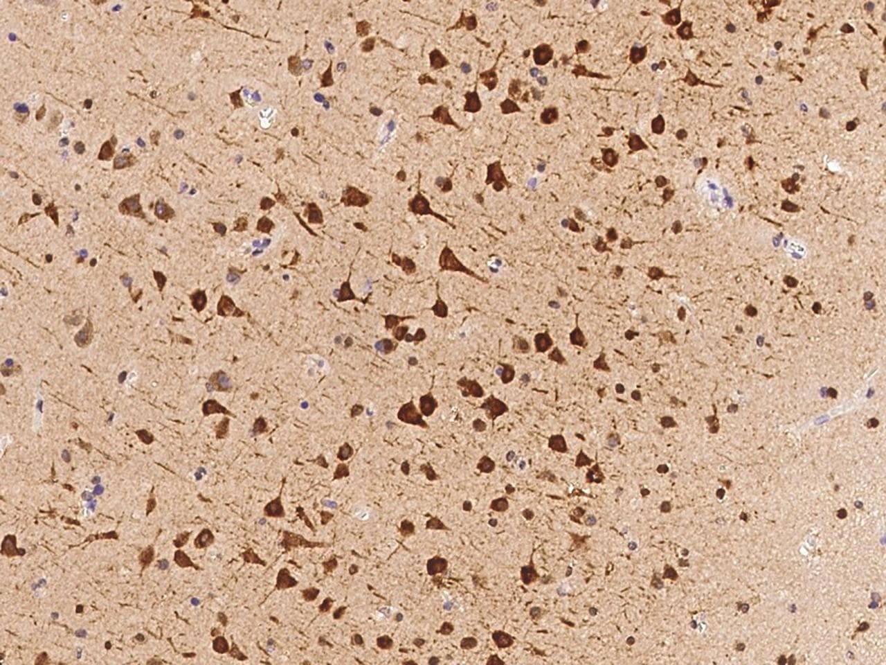 Polyclonal Rabbit anti-Human FAM181B Antibody (IHC)