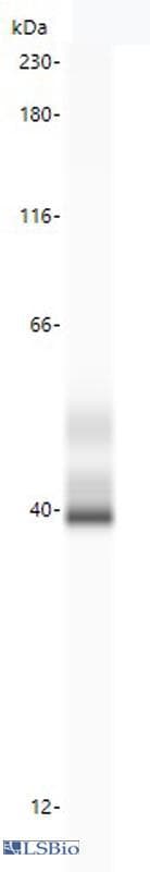 IHC-plus™ TIGIT Antibody