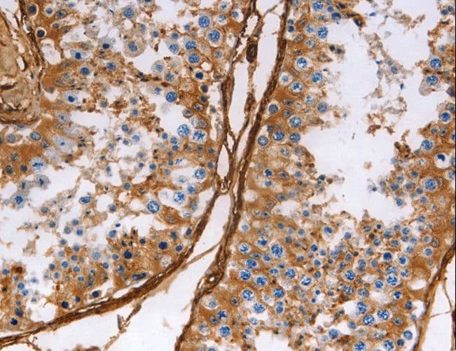 CALD1 / Caldesmon Antibody