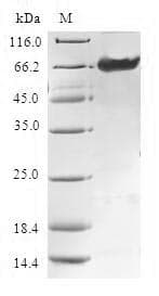 Human TMOD4 Protein (Recombinant GST, N-terminus)