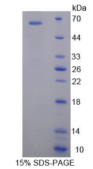 Human SLC25A20 / CACT Protein (Recombinant His-GST)