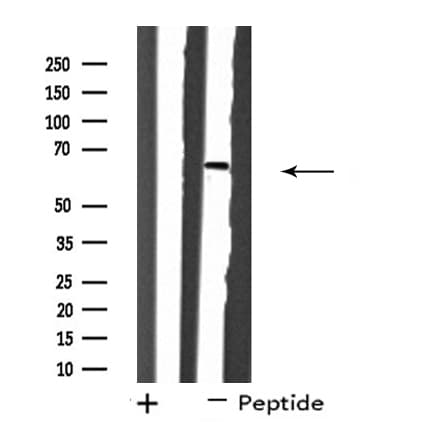 SH2B2 / APS Antibody