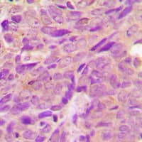 PRKAB1 / AMPK Beta 1 Antibody (Internal)