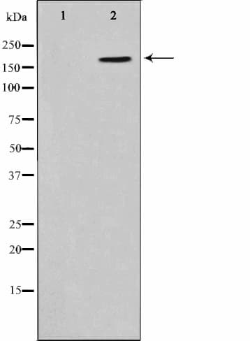 Polyclonal Rabbit anti-Human EMA / MUC1 Antibody (phospho-Tyr1229, IHC, IF, WB)